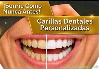 Free ad: CARILLAS DENTALES in Bogotá. CARILLAS DENTALES in Bogotá