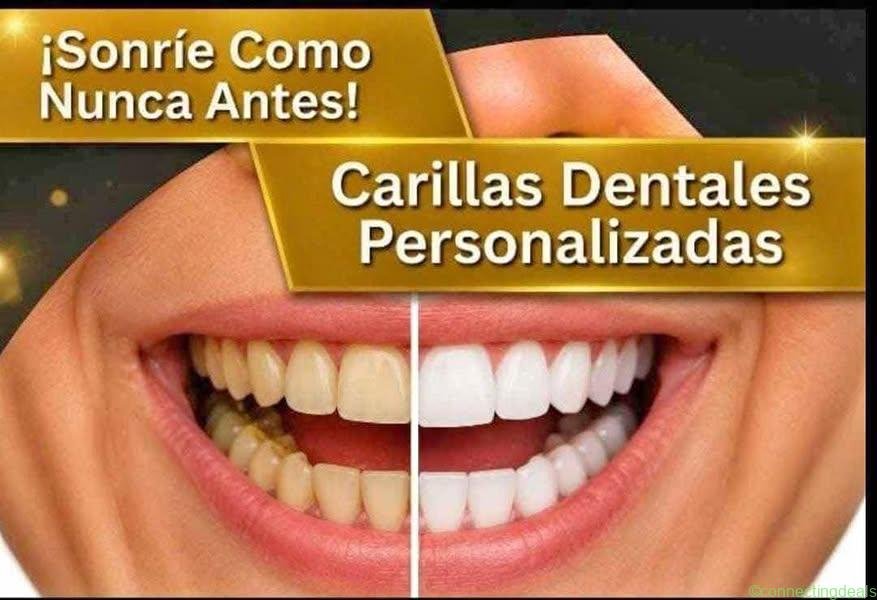 CARILLAS DENTALES